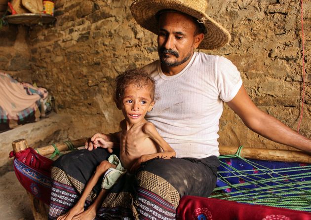 Αναστολή ανθρωπιστικής βοήθειας στην Υεμένη, ελλείψει χρηματοδότησης Αναστολή ανθρωπιστικής βοήθειας στην Υεμένη, ελλείψει χρηματοδότησης