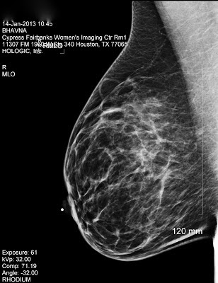 Cancer Chronicles: Mammogram and Ultrasound
