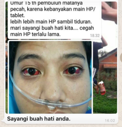 Cara Mengobati Mata Kena Radiasi Hp - Terkait Mata