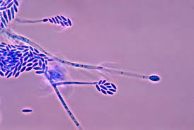 Fusarium sp. Fusarium sp.