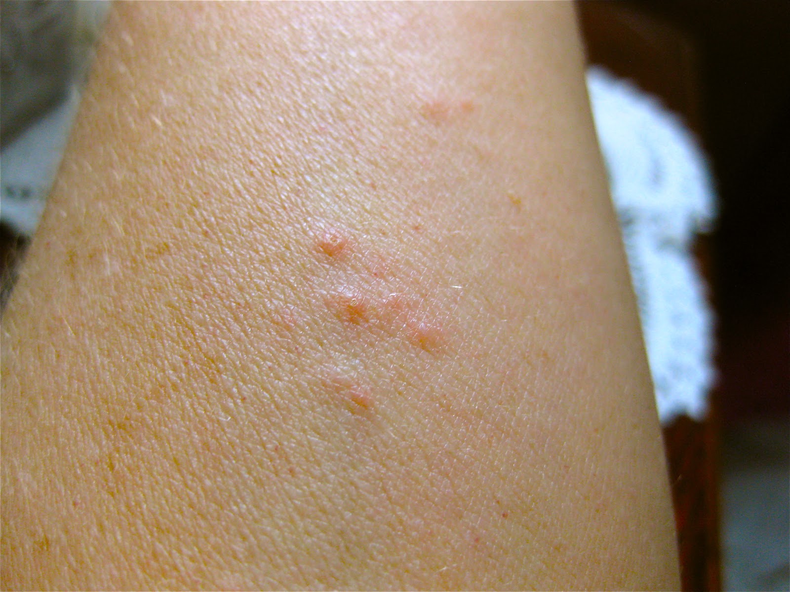 Kilohana K9s Official Blog What Do Bed Bug Bites Look Like