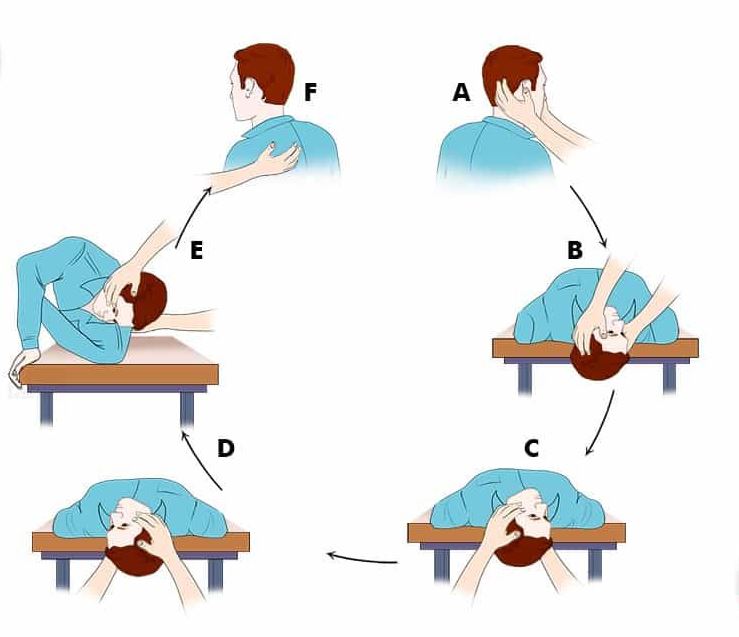 What is Benign Paroxysmal Positional Vertigo ( BPPV) ? Vertigo and