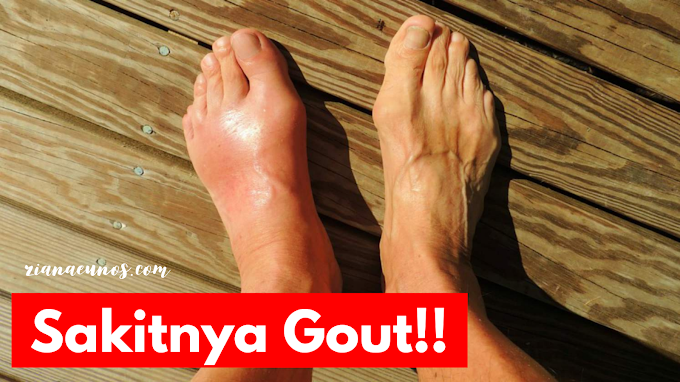 Tip sihat untuk pesakit gout
