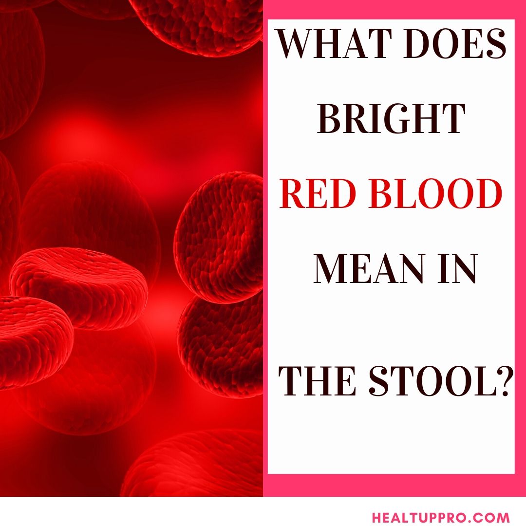 A Lot Of Red Blood In Stool