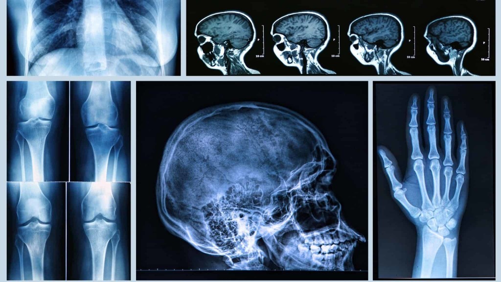 التصوير الطبي الأشعاعي (radiographic image) إشعاعي Radiation
