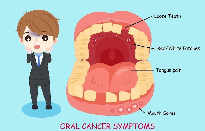 Oral Cancer Symptoms.......💥💥💥