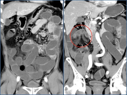 الاشعات على المخ أخصائي تصوير اشعة