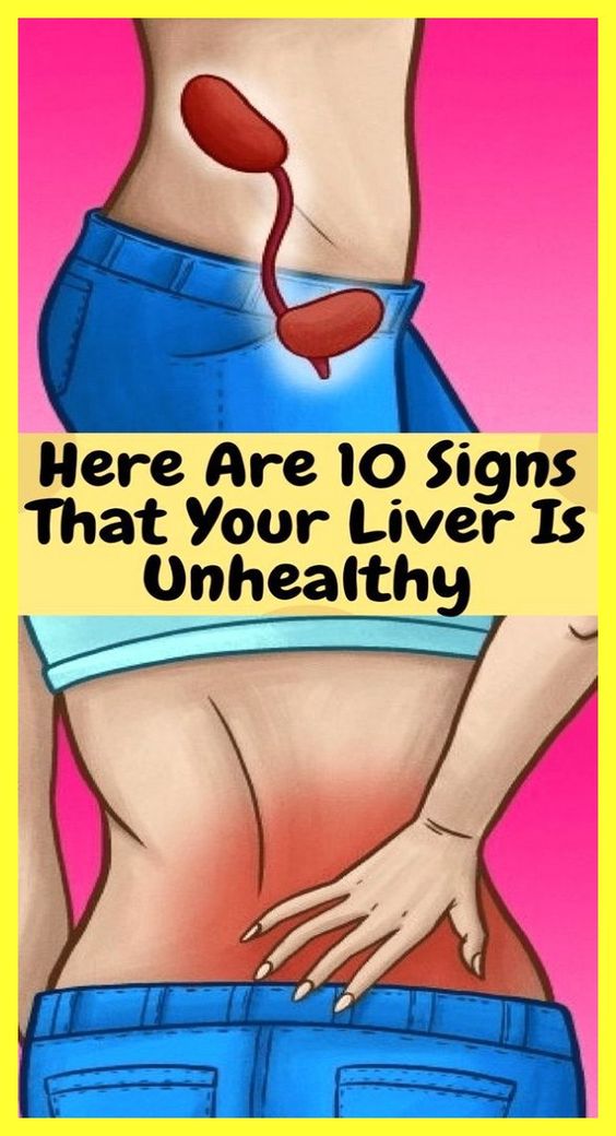Here Are 10 Signs That Your Liver Is Unhealthy wellness days