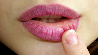 10 Cara Alami Mengobati Bibir Kering dan Pecah-Pecah