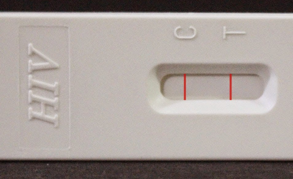 HIV Test Kit Review in Philippines