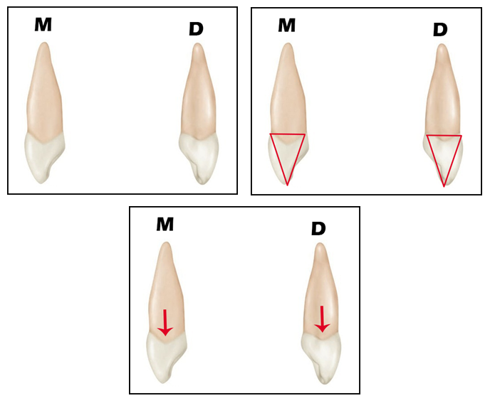 Aula de Anatomia Dental Canino Superior Dente 13 e 23 Arriba Dentista Aula de Anatomia Dental Canino Superior Dente 13 e 23 Arriba Dentista
