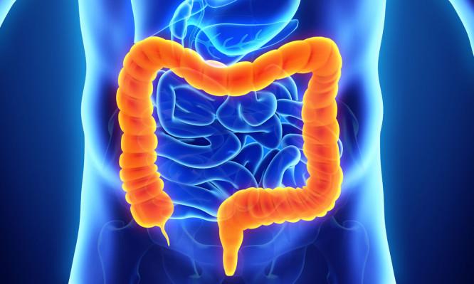 Καρκίνος παχέος εντέρου – Οι τροφές που «θωρακίζουν» την υγεία