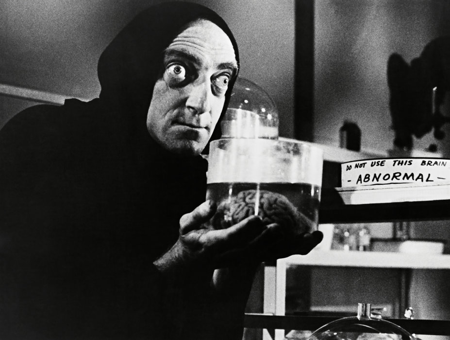 Marty Feldman in Young Frankenstein: Damn Your Eyes!