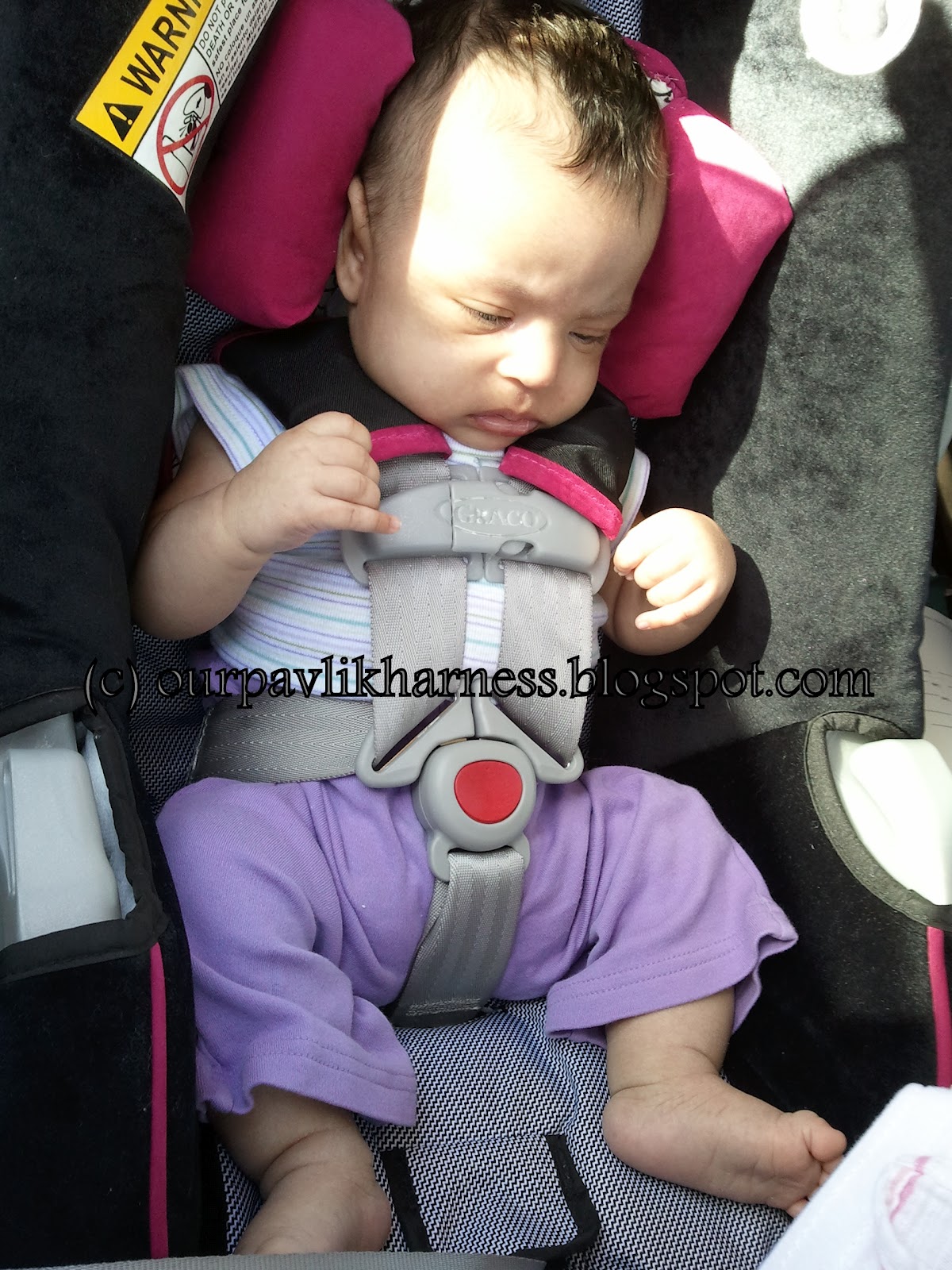 Our Pavlik Harness and journey with Hip Dysplasia meet Rhino and the