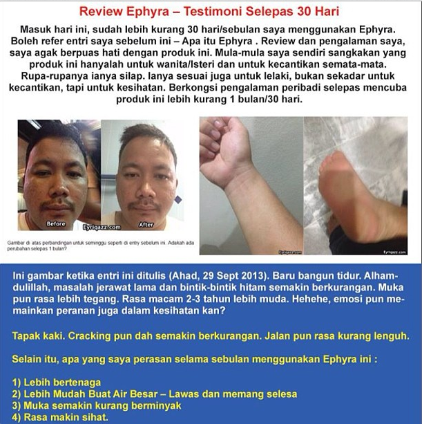 Testimonial Eyriqazz Selepas 30 hari Consume Ephyra Testimonial Eyriqazz Selepas 30 hari Consume Ephyra