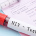 Νέο τεστ ανιχνεύει τον κρυμμένο ιό HIV
