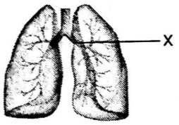 Perhatikan gambar berikut! Pernyataan-pernyataan berikut yang