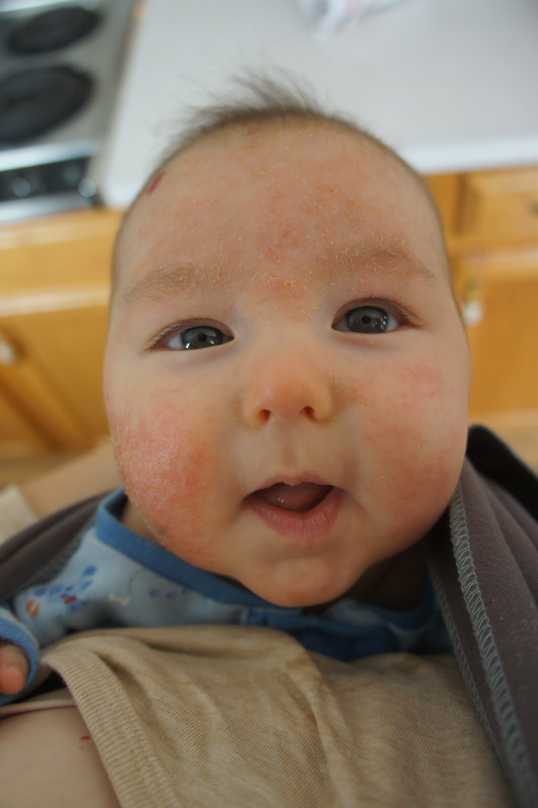 The Modern Housewife Treating Baby Eczema