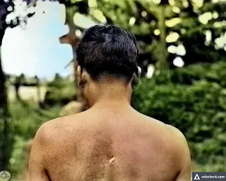 A man shows bayonet wound on his back. Image source: United States National Archives.