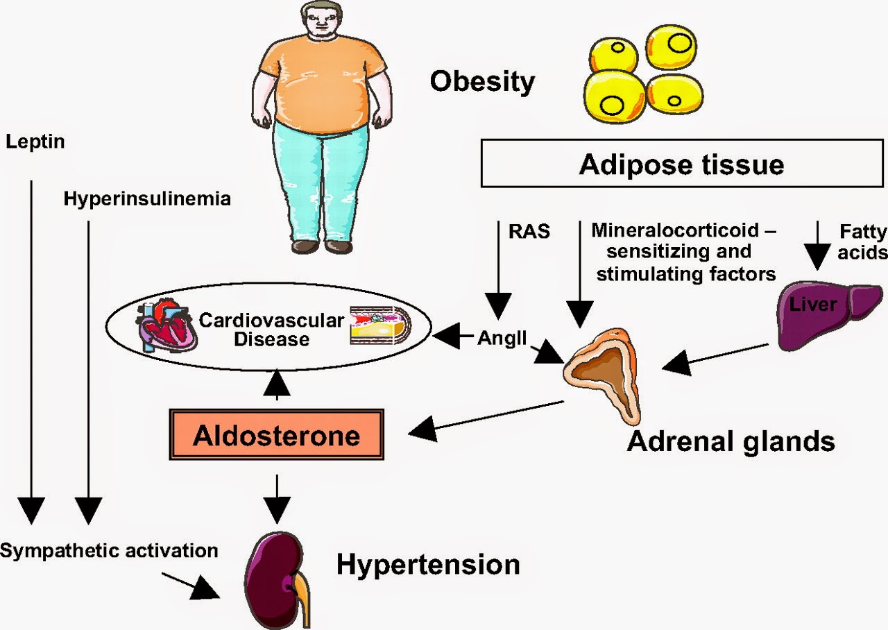 "Asam Urat Adalah Penyebab Sindrom Metabolik"