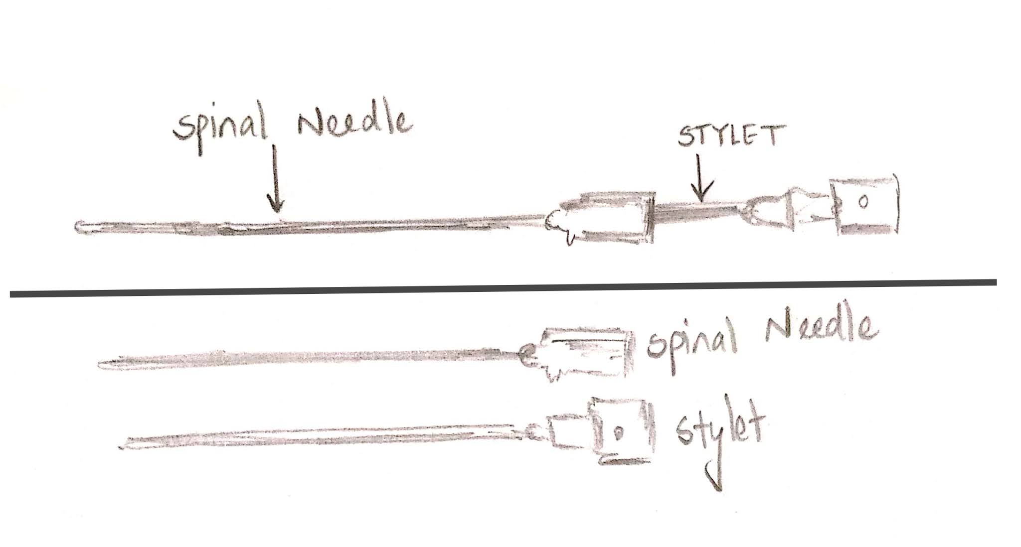 Medicowesome Spinal Anesthesia