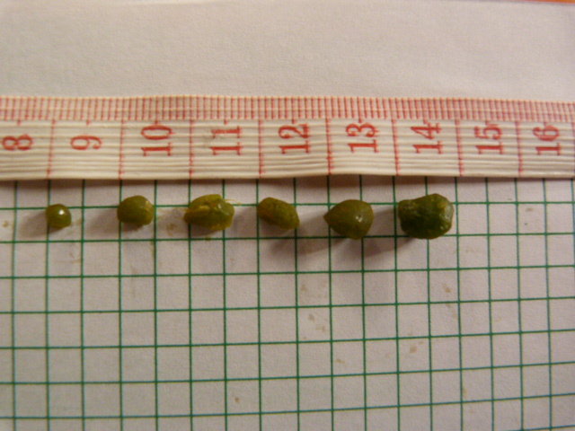 Share for the Greater Good: Flushing Out Gallstones Naturally