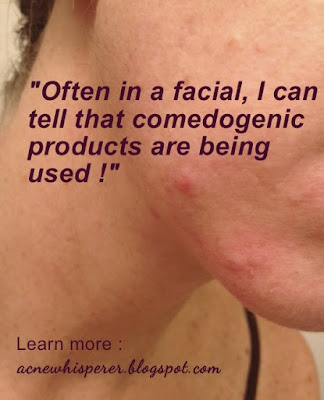 Often in a facial, I can tell that comedogenic products are being used!