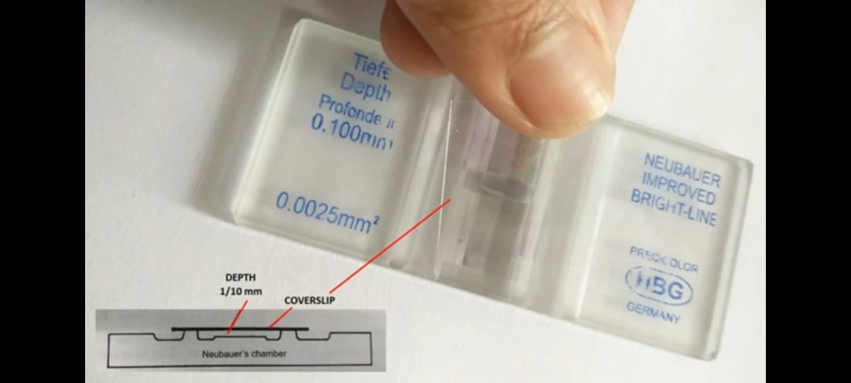 Manual Cell Counting Using Neubauer Chamber RBC Count WBC Count