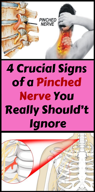 Let Start Slim Today: 4 Crucial Signs of a Pinched Nerve You Really