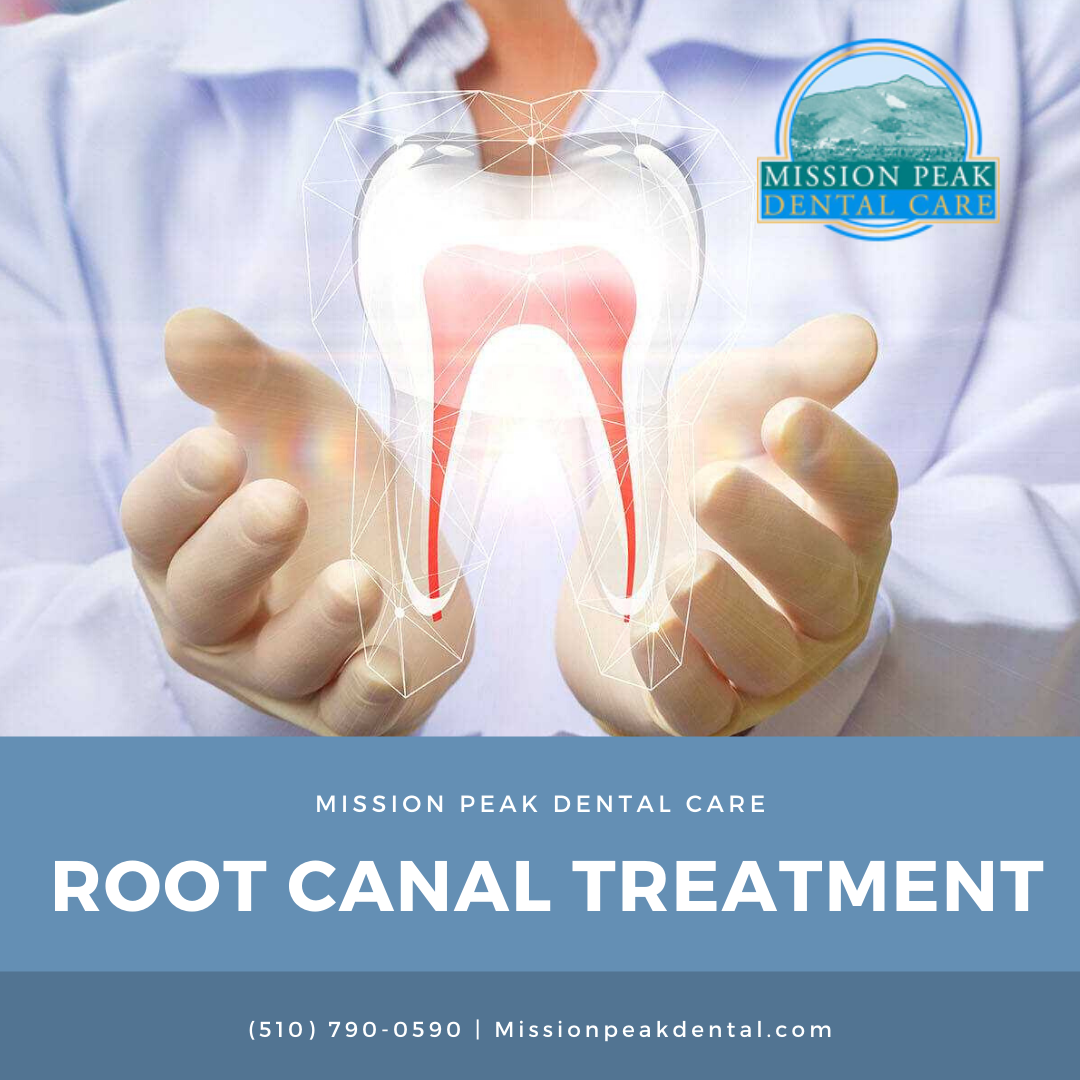 Root Canal Treatment For Injured Teeth