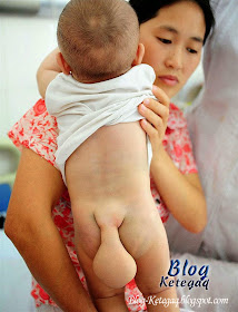 Bayi berekor di China