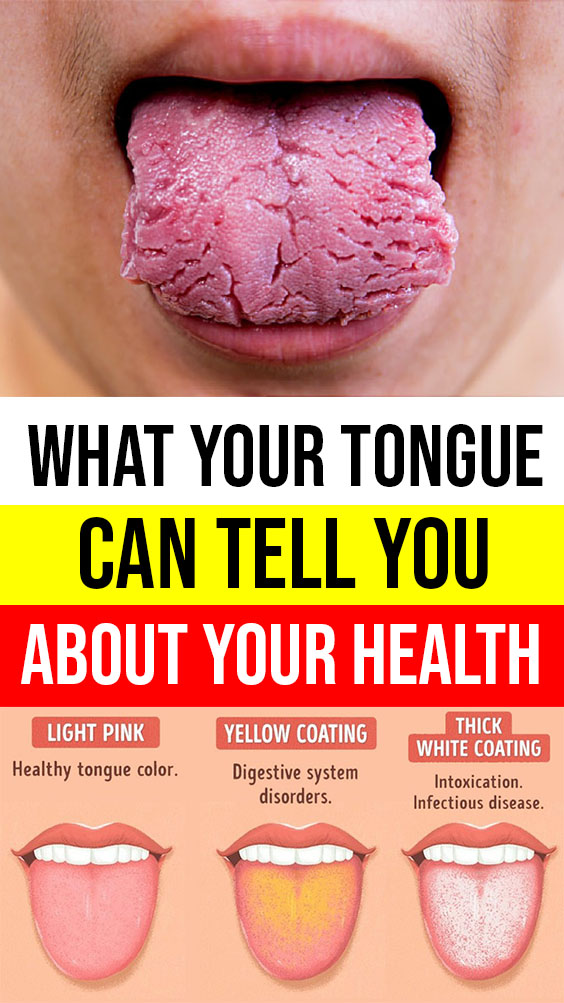 What Your Tongue Is Trying To Tell About Your Health Healthy Lifestyle