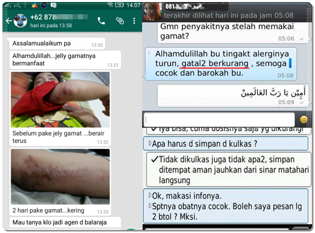 Pengobatan Eksim Untuk Bayi dan Balita Secara Tradisional Pengobatan Eksim Untuk Bayi dan Balita Secara Tradisional
