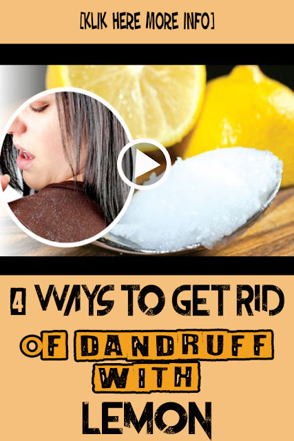How To Get Rid Of Dandruff With Lemon - grendbeauty