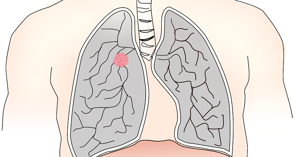 Pharmacotherapy/Treatment Of Hiccup