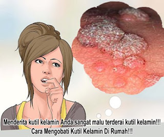 Kutil di kemaluan lelaki, kutil kecil pada kelamin pria, pengobatan kutil kelamin bagi ibu hamil, pengobatan kutil kelamin tanpa operasi di jakarta, obat tradisional utk kutil kelamin, kapur sirih untuk obat kutil kelamin atau kutil di kemaluan, mengobati kutil kelamin dengan daun sirsak, salep penghilang kutil di kemaluan, obat menyembuhkan kutil kelamin atau kutil di kemaluan, cara mengobati kutil pada kelamin, cara penyembuhan kutil pada kemaluan pria