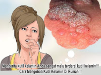 Obat Kutil Kelamin Atau Kutil Di Kemaluan Wanita