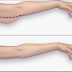 Do This For 5 Minute Daily Work Out And Get Rid of Arm Fat and Flabby Muscles In Just 1 Week