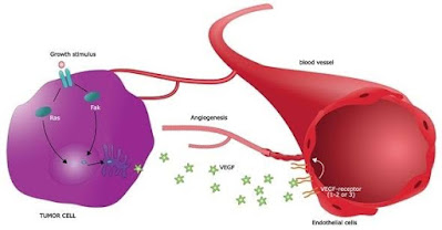 angiogenisis