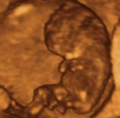 9 haftalık hamilelik görüntü