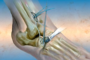 A New Chapter...: Twelve months down the track...