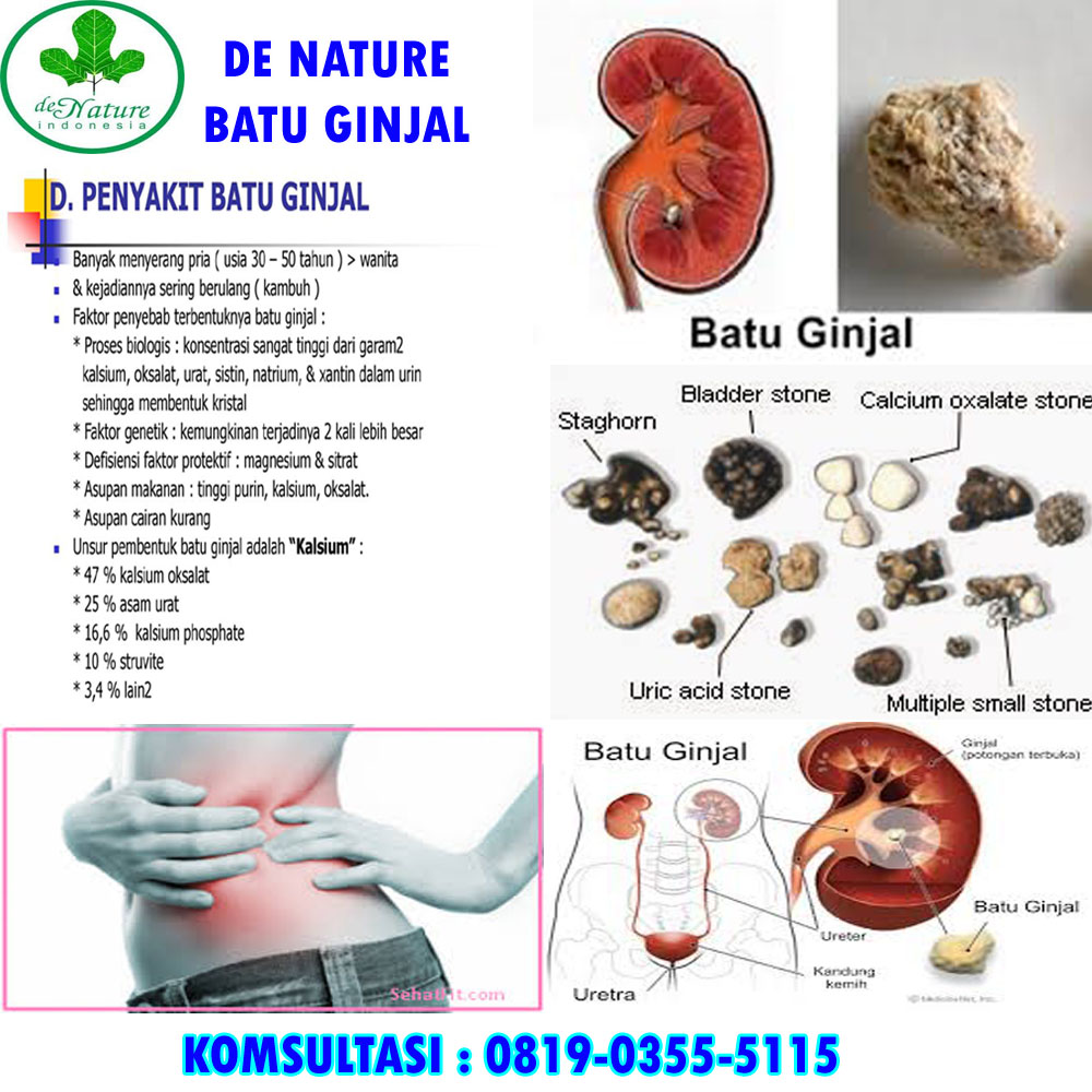 KUMPULAN NAMA DAN HARGANYA OBAT BATU GINJAL HERBAL DI APOTIK RESEP