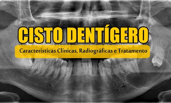 CISTO DENTÍGERO: Características Clínicas, Radiográficas e Tratamento