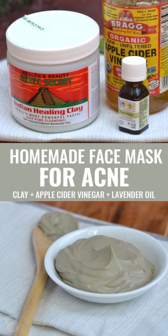 Homemade Face Mask for Acne - Tips Dietz