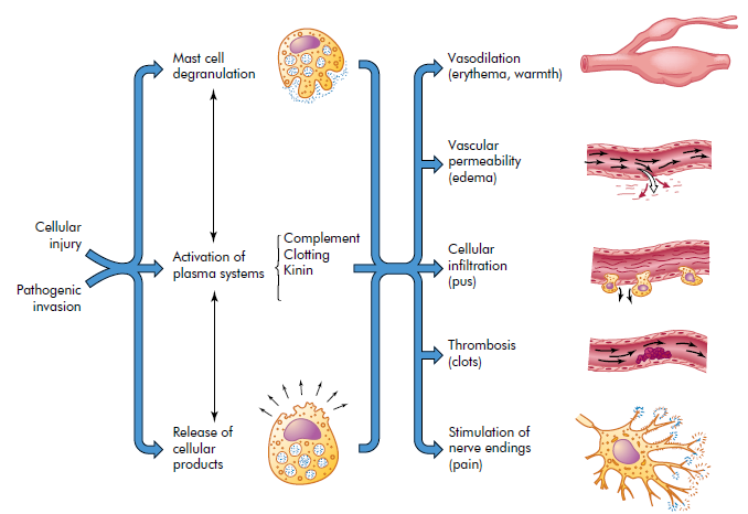 Inflammation | Your Medical Advices