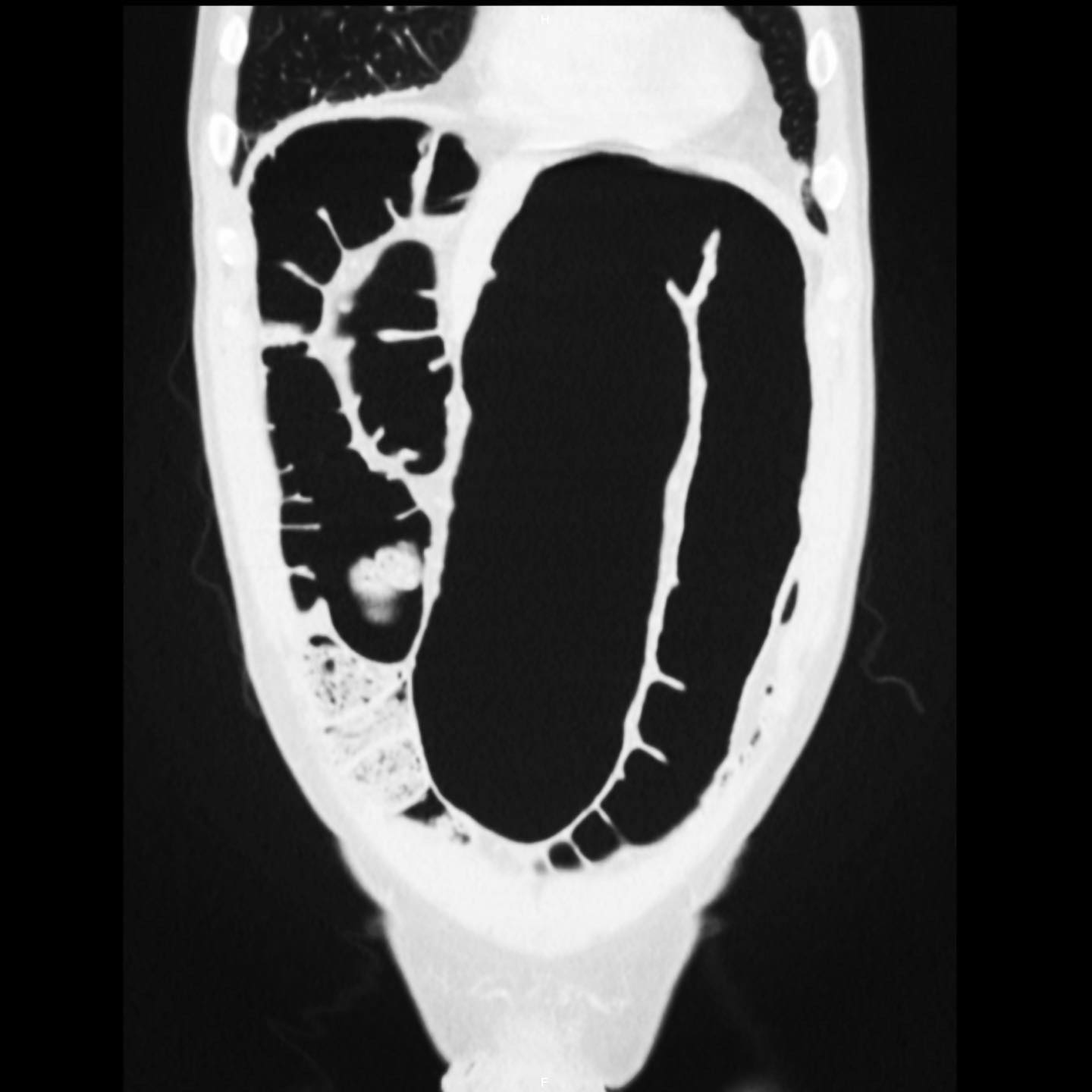 EL RINCÓN DE LA MEDICINA INTERNA. VARÓN