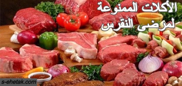 الأكلات الممنوعة لمرضى النقرس الأكلات الممنوعة لمرضى النقرس