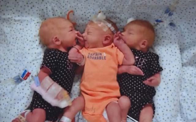 Mulher vai ao hospital achando que tem pedra nos rins e sai com trigêmeos