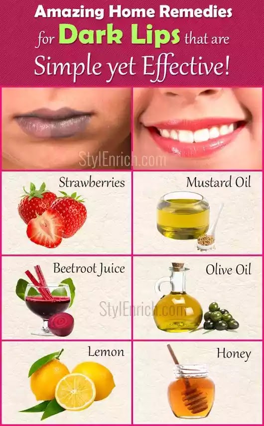 Amazing Home Remedies For Dark Lips That are Simple Yet Effective