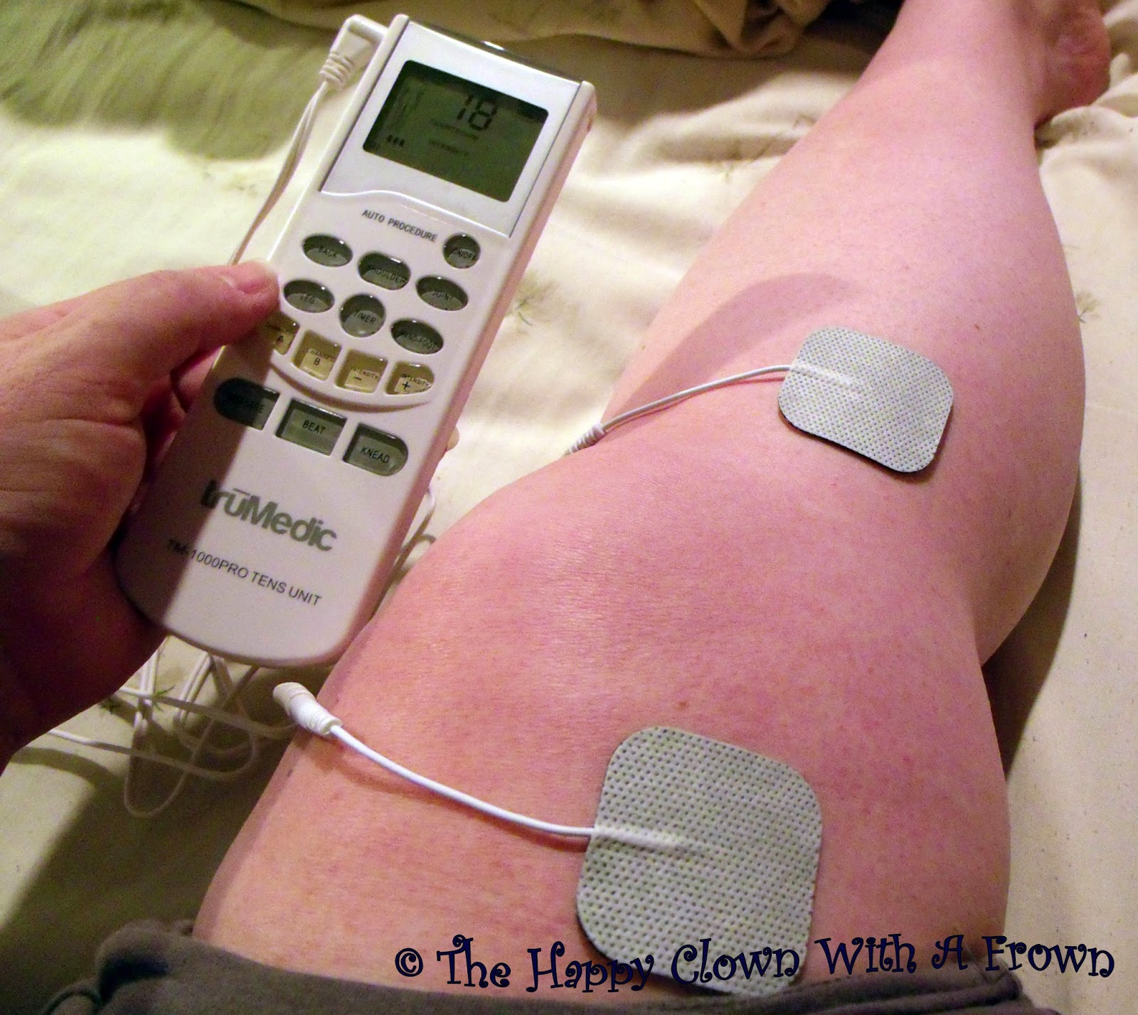 The Happy Clown With A Frown TruMedic TM1000PRO Deluxe TENS Unit Review